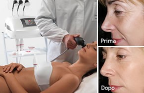 Radio Frequenza Dermal Istitute